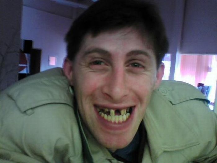   (90 )